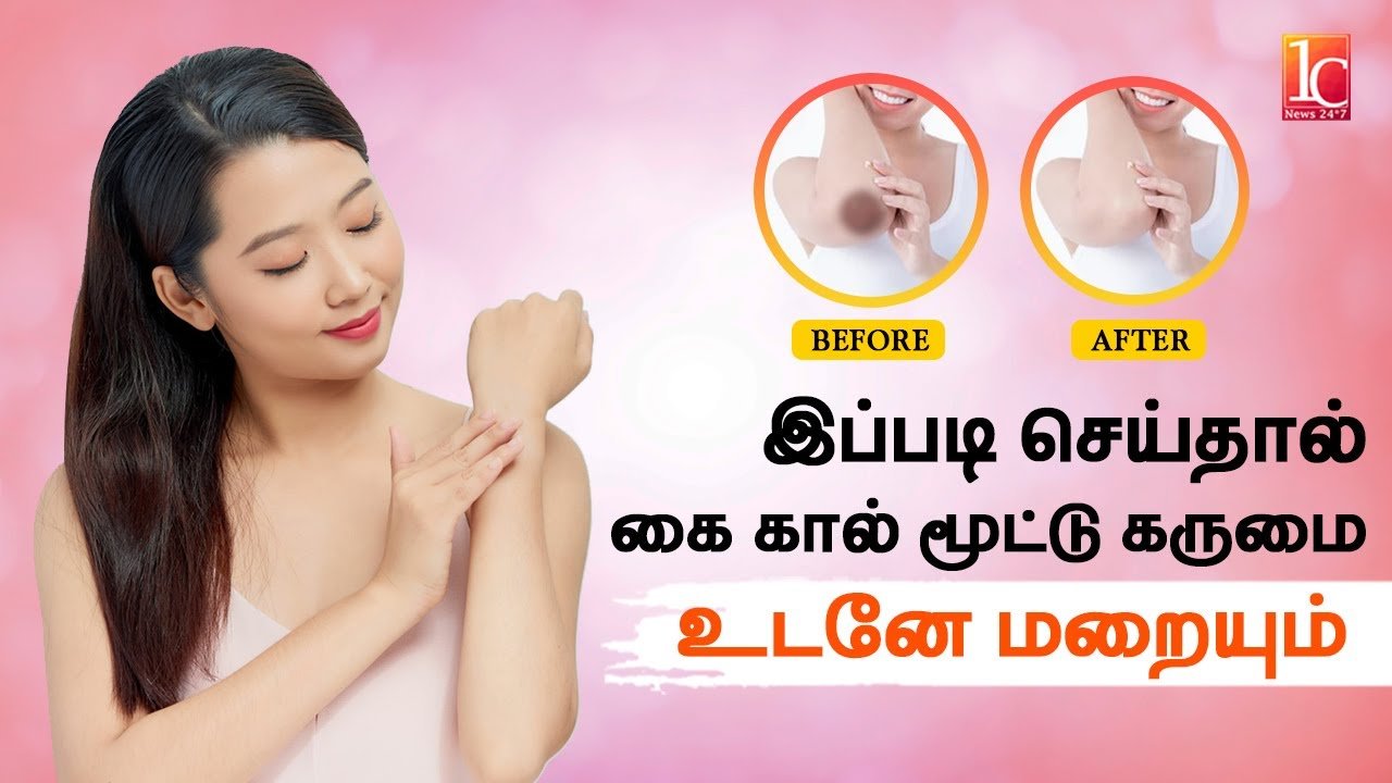 கை கால் முட்டியில் உள்ள கருமை போக இதை செய்து பாருங்கள் |How To Lighten Dark Elbows Naturally at Home